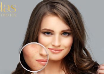 Hydration vs Moisture