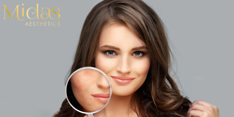 Hydration vs Moisture