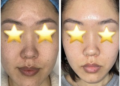 best facial in pasadena