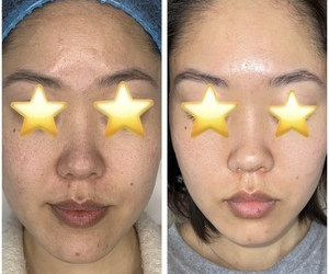 best facial in pasadena