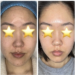 best facial in pasadena