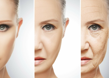 Botox wrinkles Treatment