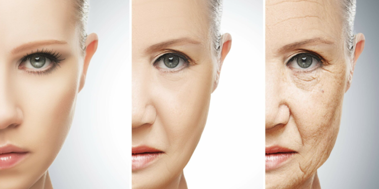 Botox wrinkles Treatment