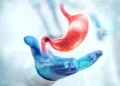 best bariatric surgeon in Delhi