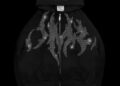 BLADE-RHINESTONE-ZIP-HOODIE-BLAC